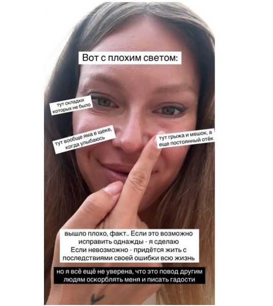 Дакота призналась, что сделала неудачную пластику